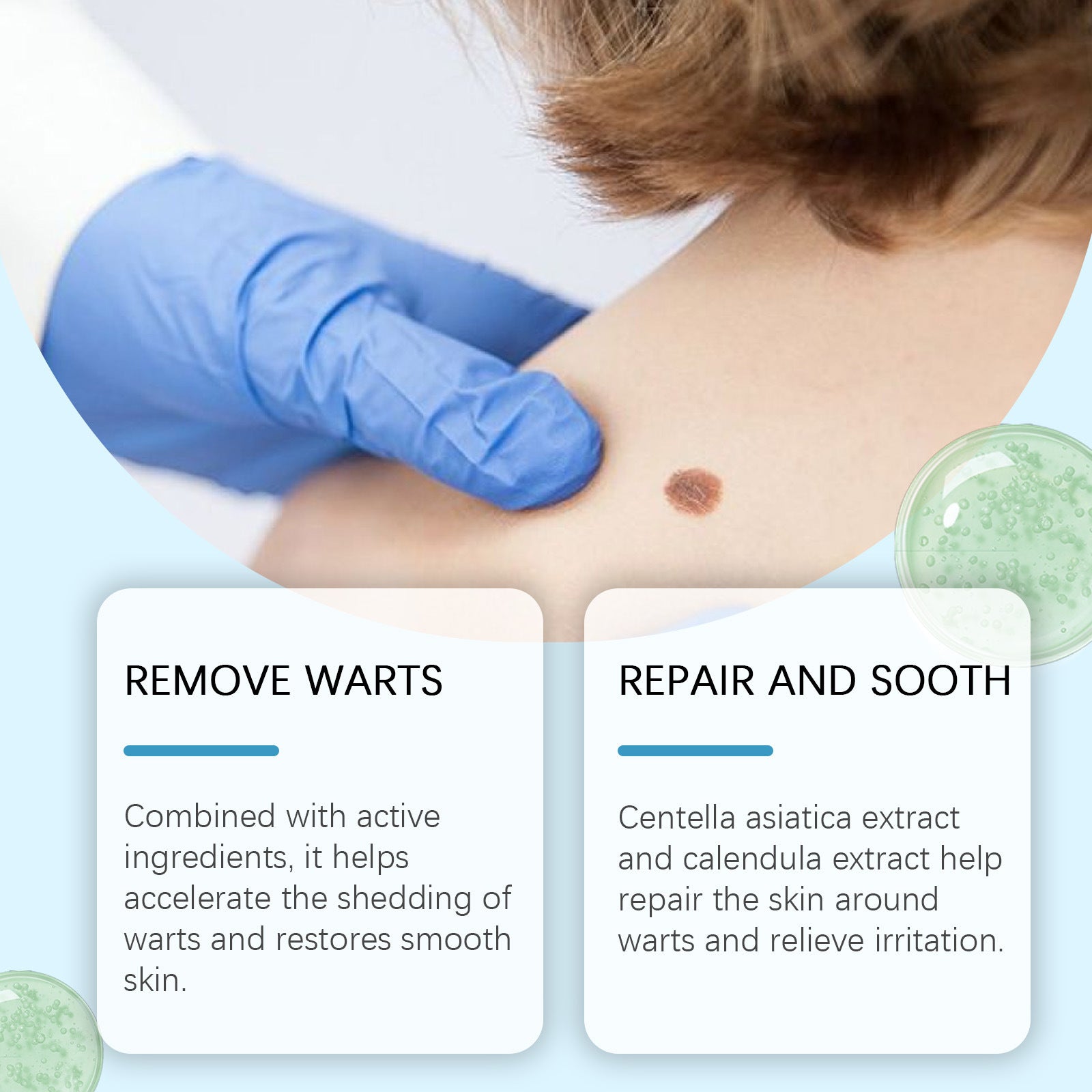 Effective Wart Removal Patches - 120 Count
