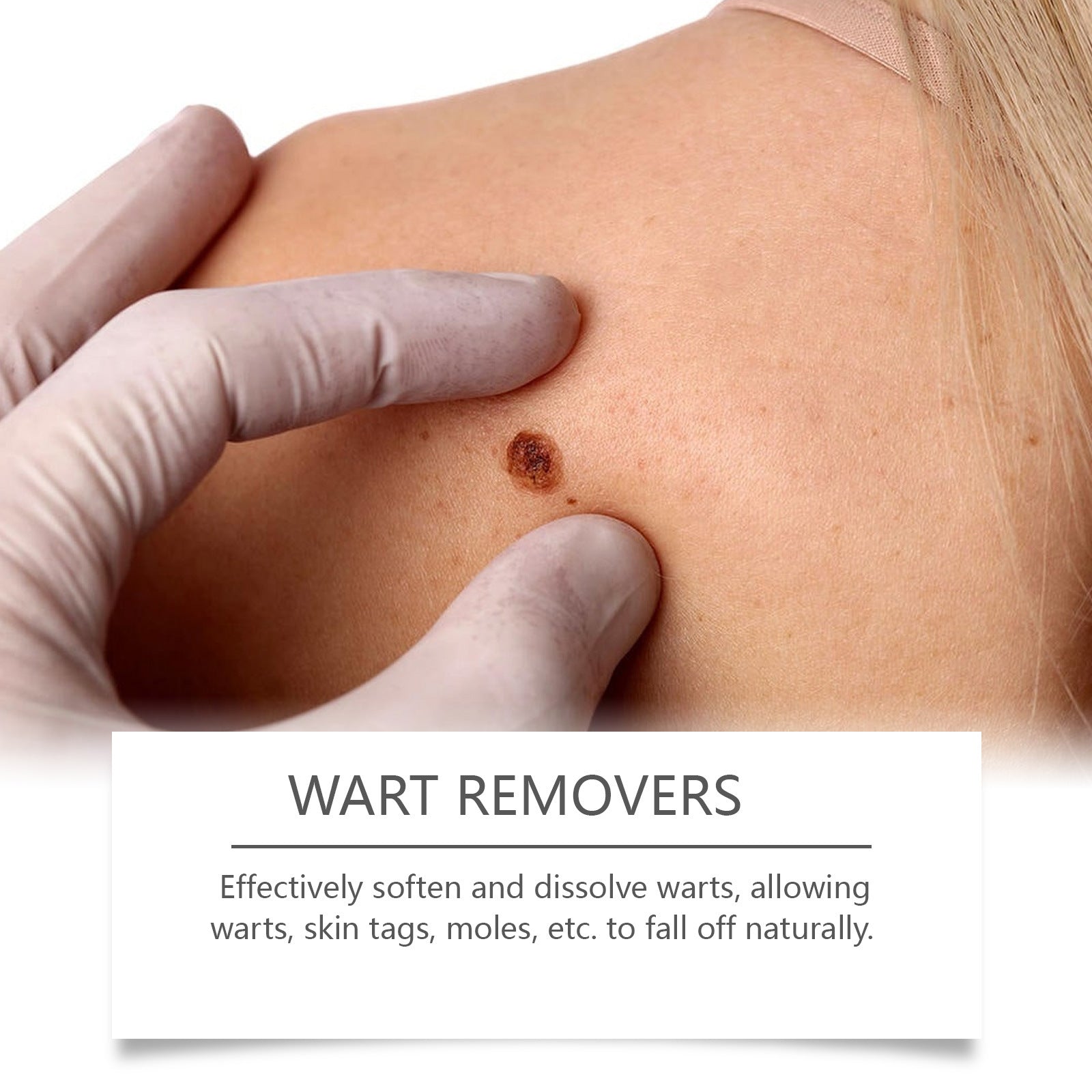 Effective Wart Removal Patches - 120 Count